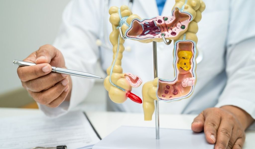 Appendix Cancer: Early Signs, Diagnosis, and Infusion Therapy Treatment Strategies
